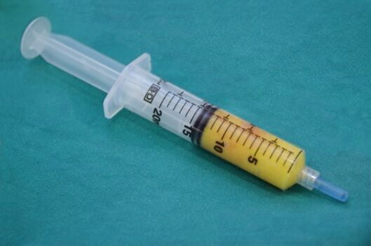 Syringe with adipose tissue for lipofilling