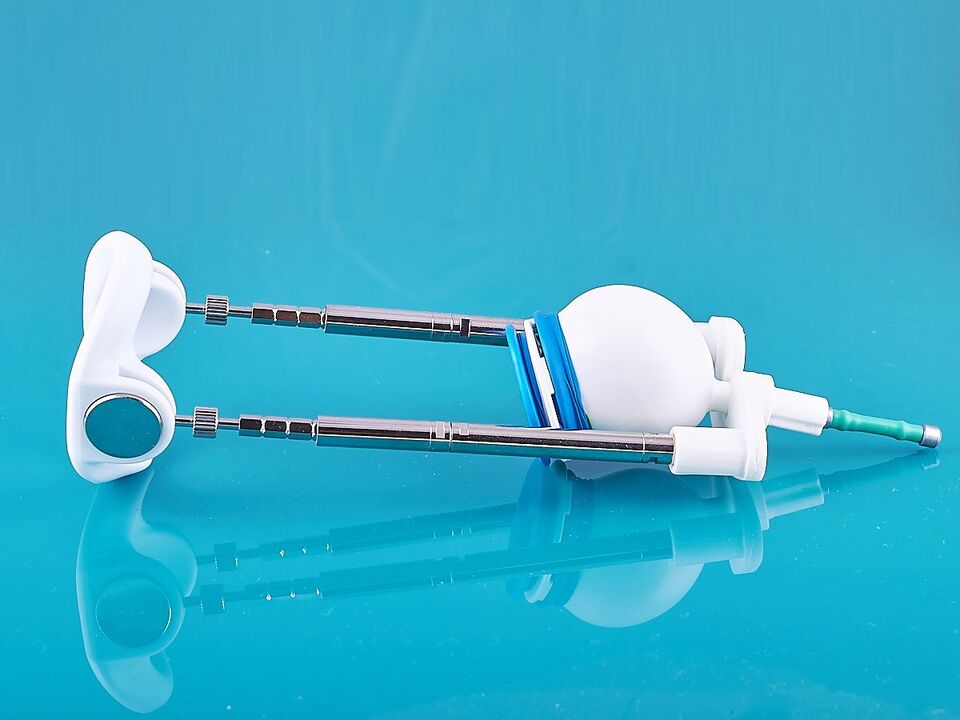 The extender will help improve the result of ligamentotomy